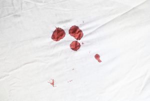 Bloodstains on a white sheet
